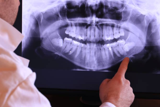 Best Dentist for Tooth Abscess  in Trucksville, PA