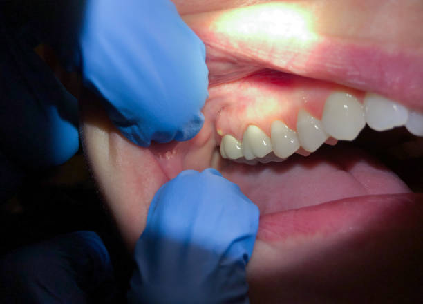 Best Emergency Gum Pain Relief  in Trucksville, PA